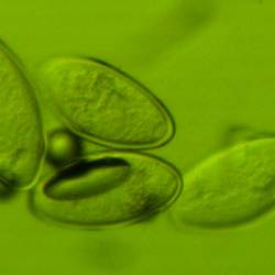 Eggs free in stool sample seldom found unless female also in sample