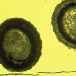 Roundworms egg as seen on fecal egg count Chamber