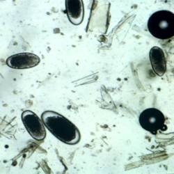 Strongyle eggs as seen in a microscopic fecal egg count