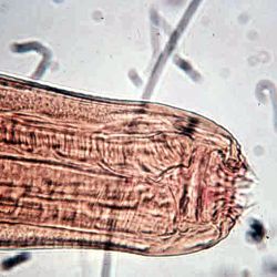 Microscopic view of strongyle larva mouth parts for species identification